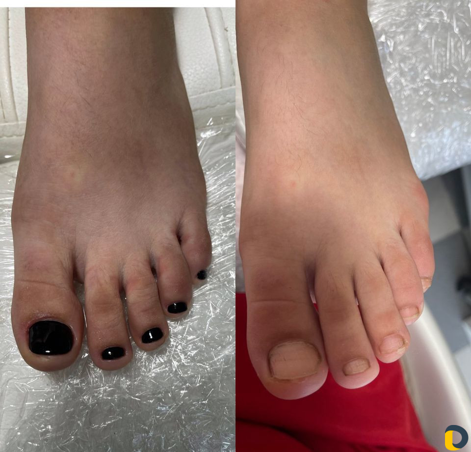 Смарт педикюр