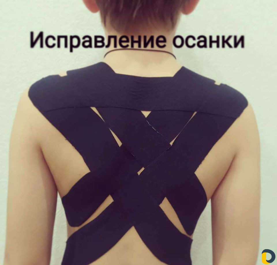 Тейпирование