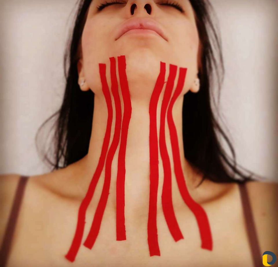 Тейпирование