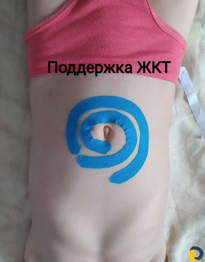 Тейпирование