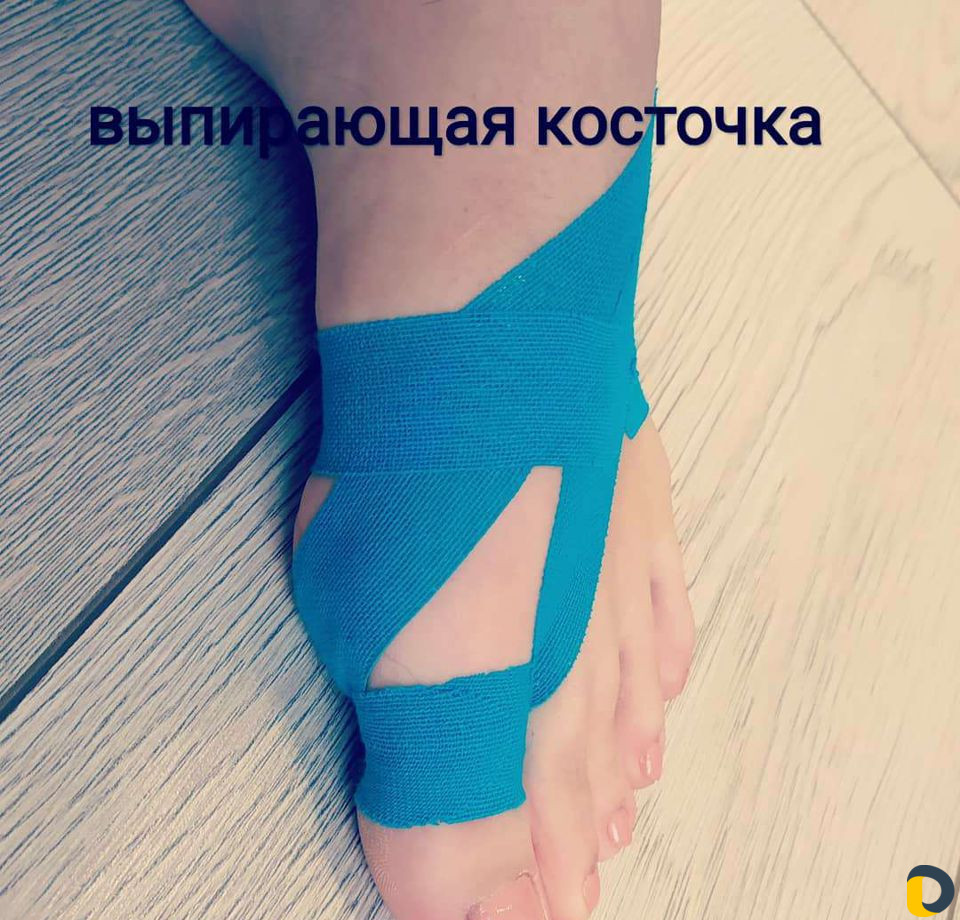 Тейпирование