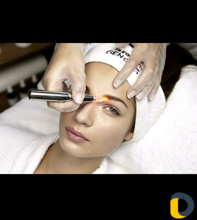 Удаление татуажа лазером