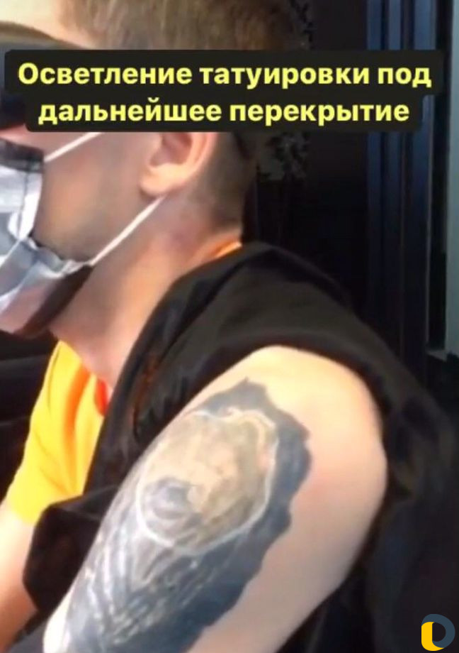Удаление татуировок и перманентного макияжа