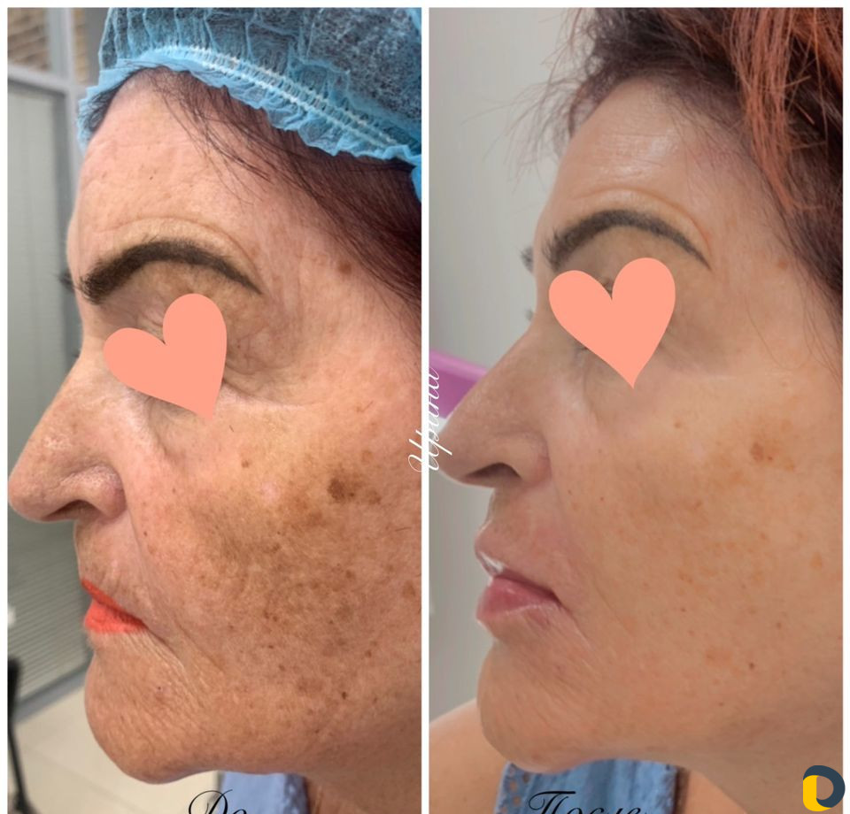 Услуги Косметолога