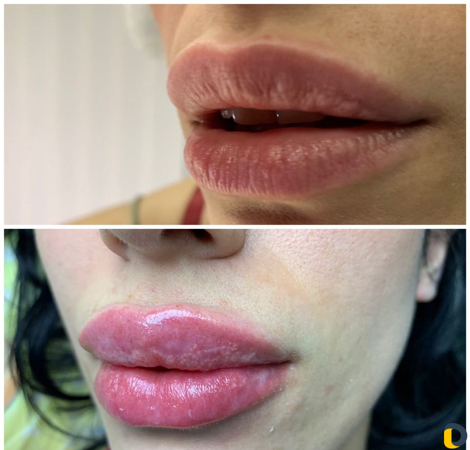 Услуги Косметолога