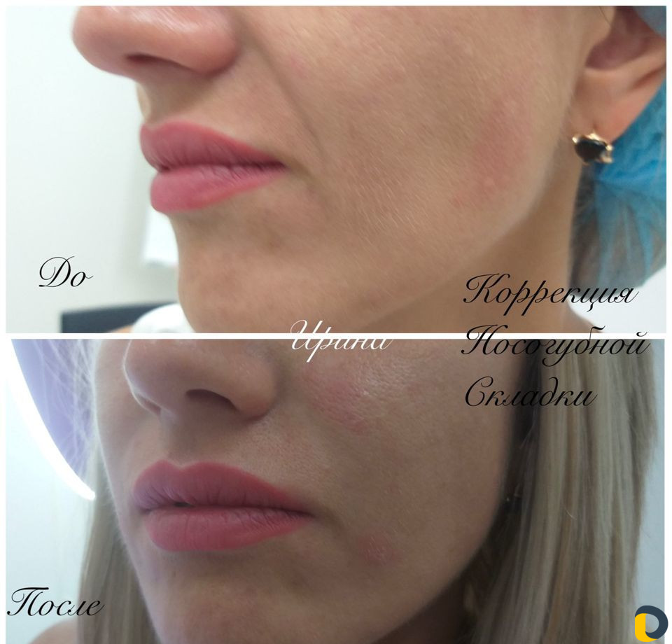 Услуги Косметолога