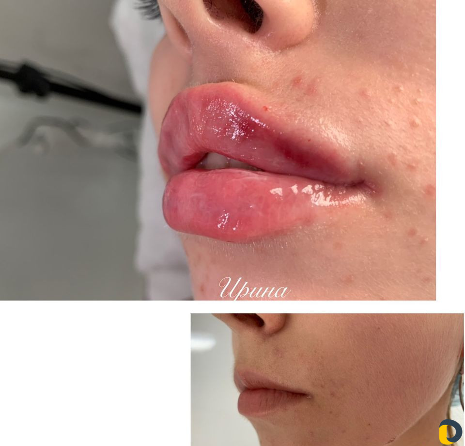 Услуги Косметолога