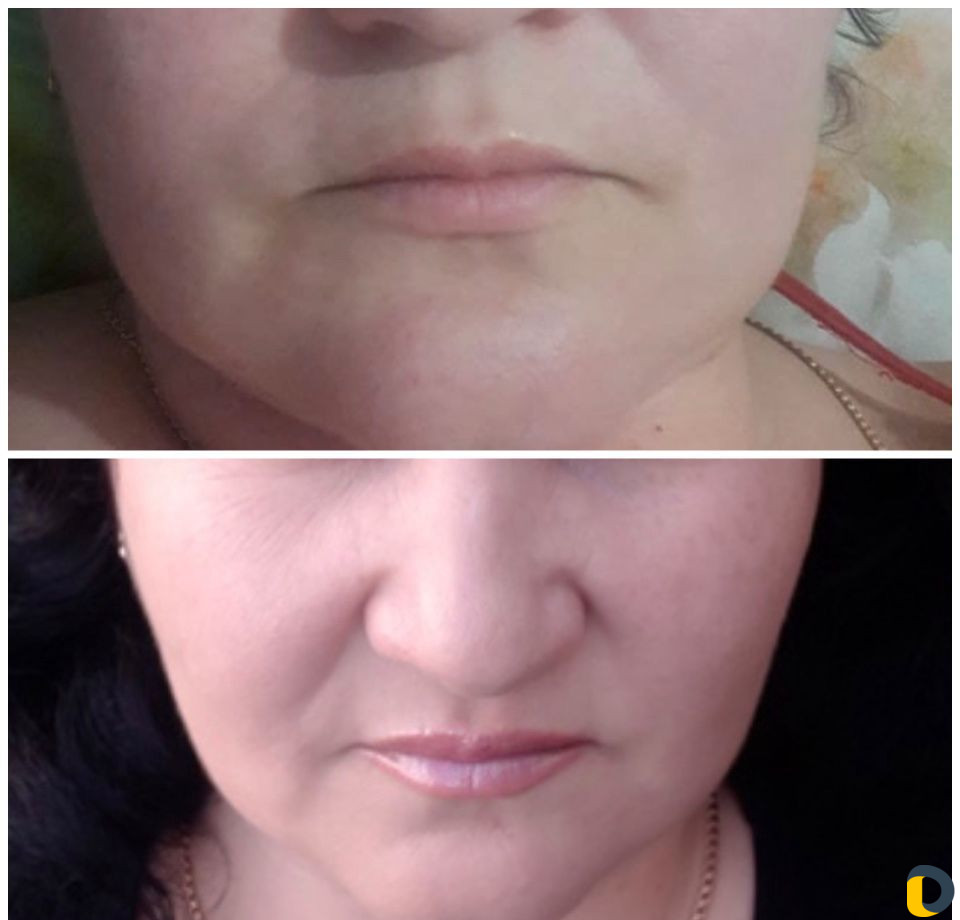 Услуги Косметолога