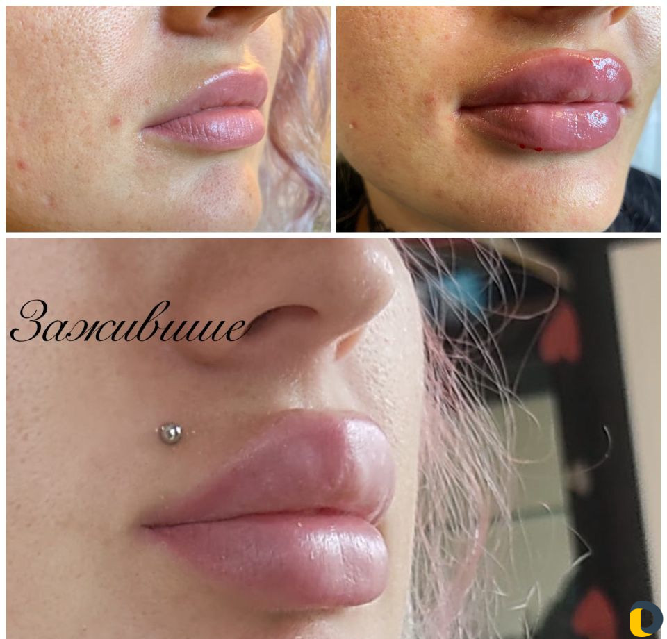 Услуги Косметолога