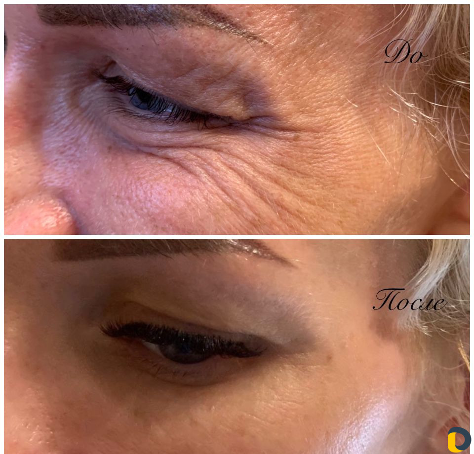 Услуги Косметолога