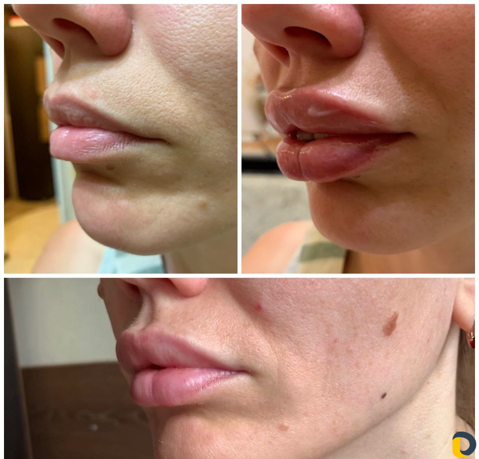 Услуги Косметолога