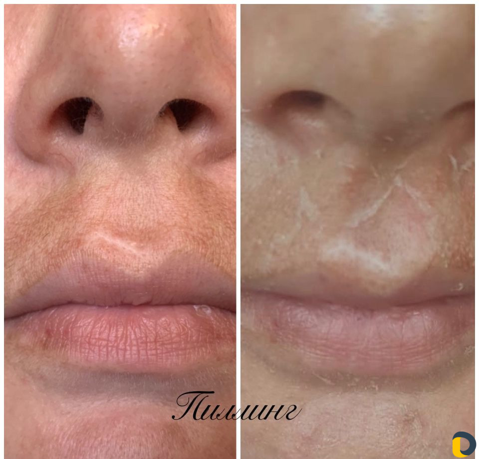 Услуги Косметолога