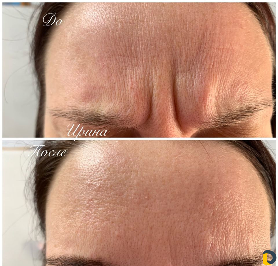 Услуги Косметолога