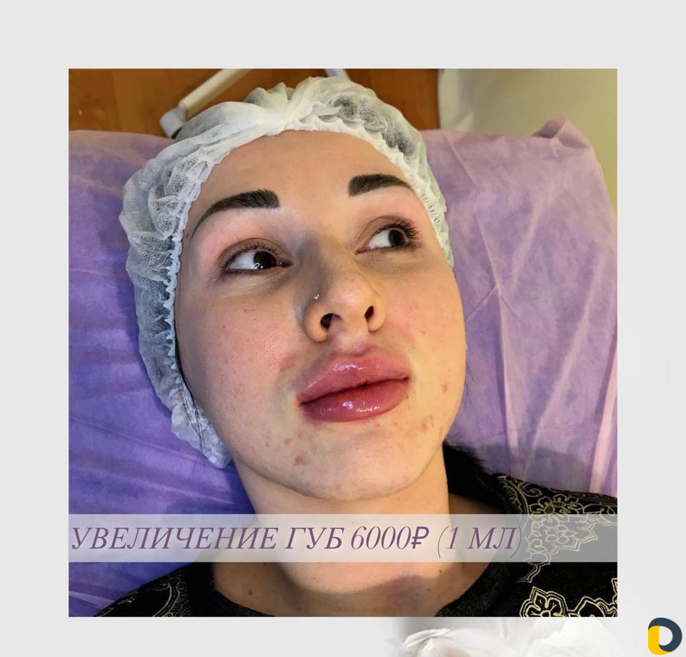Услуги косметолога