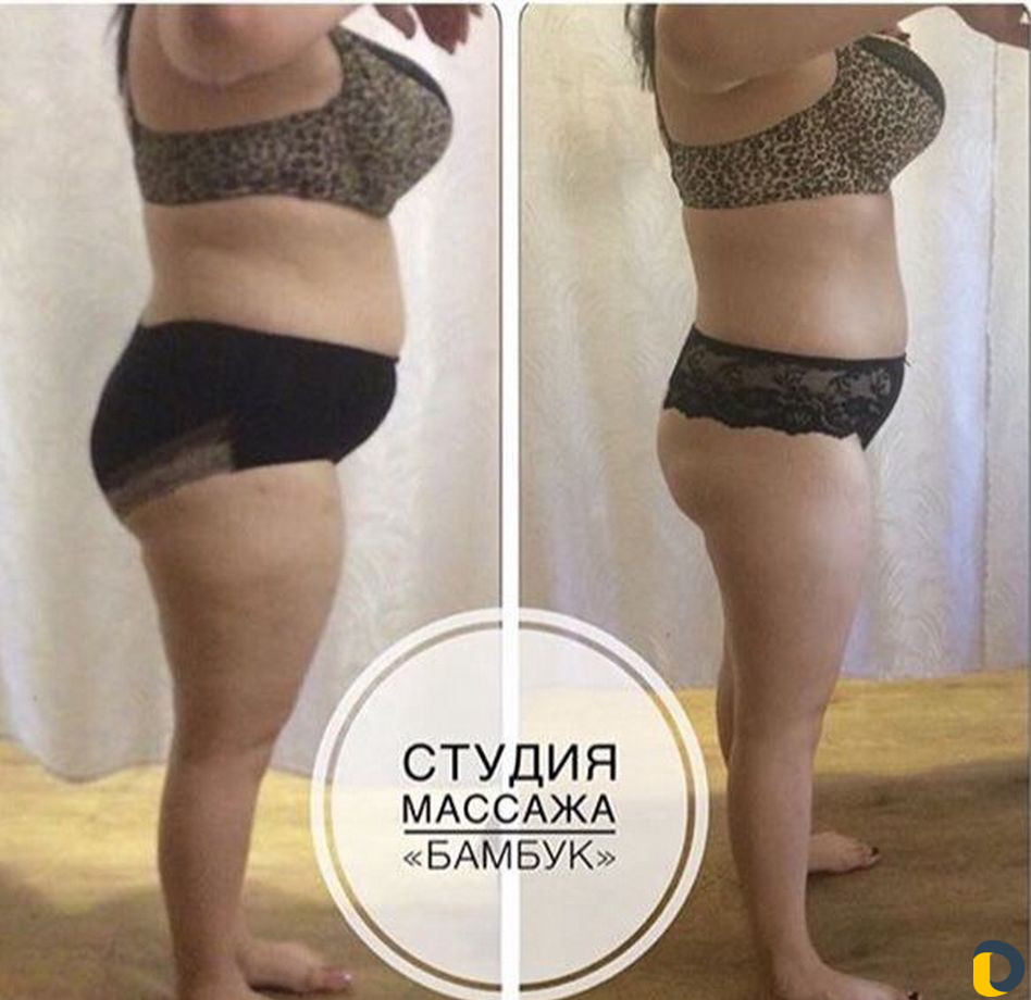 Услуги профессионального массажа