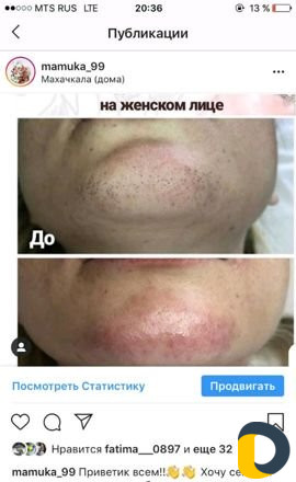 Узи чистка лица