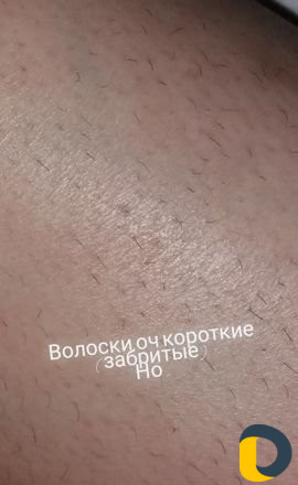 Воск депиляция воском