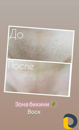 Воск депиляция воском