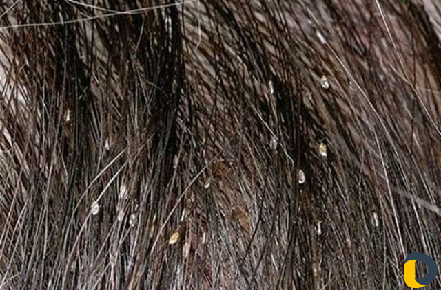 Здоровье и красота