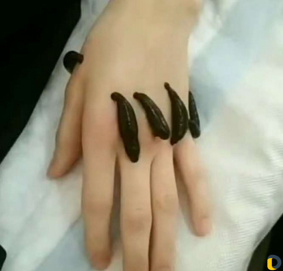 Здоровье