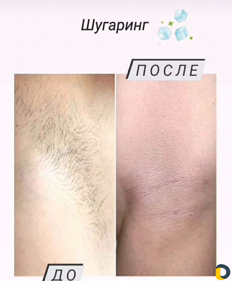 Женский и мужской шугаринг