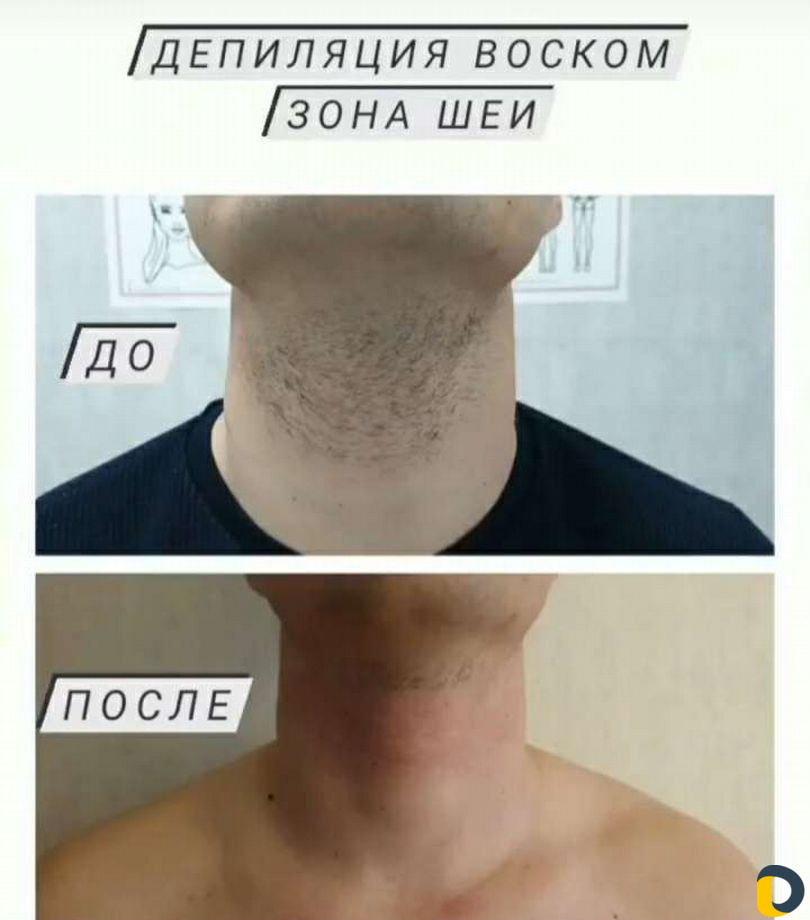 Женский и мужской шугаринг