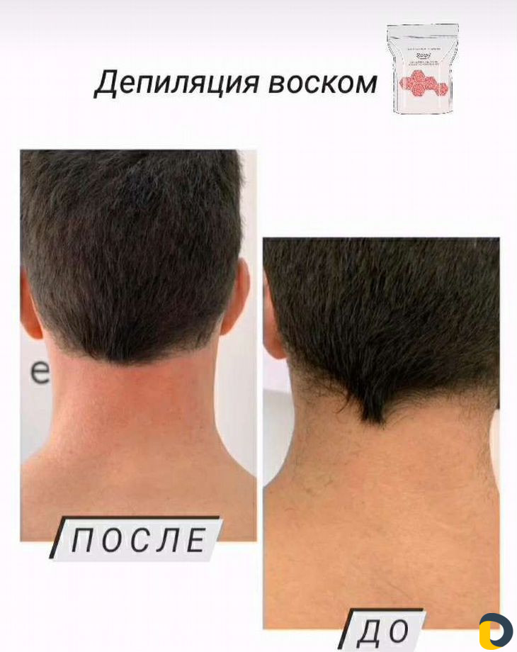 Женский и мужской шугаринг