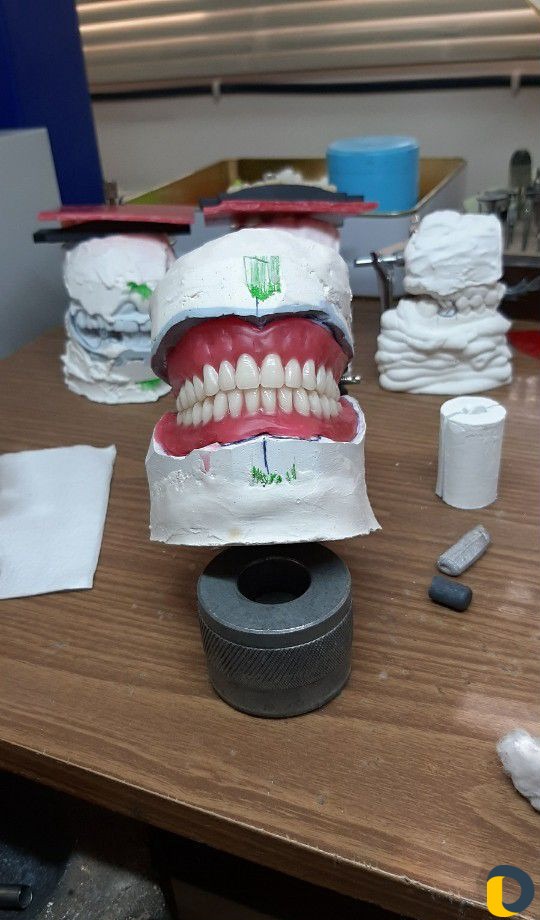 Зубной техник -литейщик