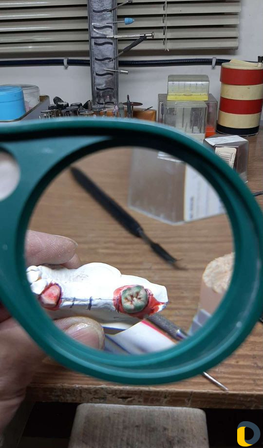 Зубной техник -литейщик