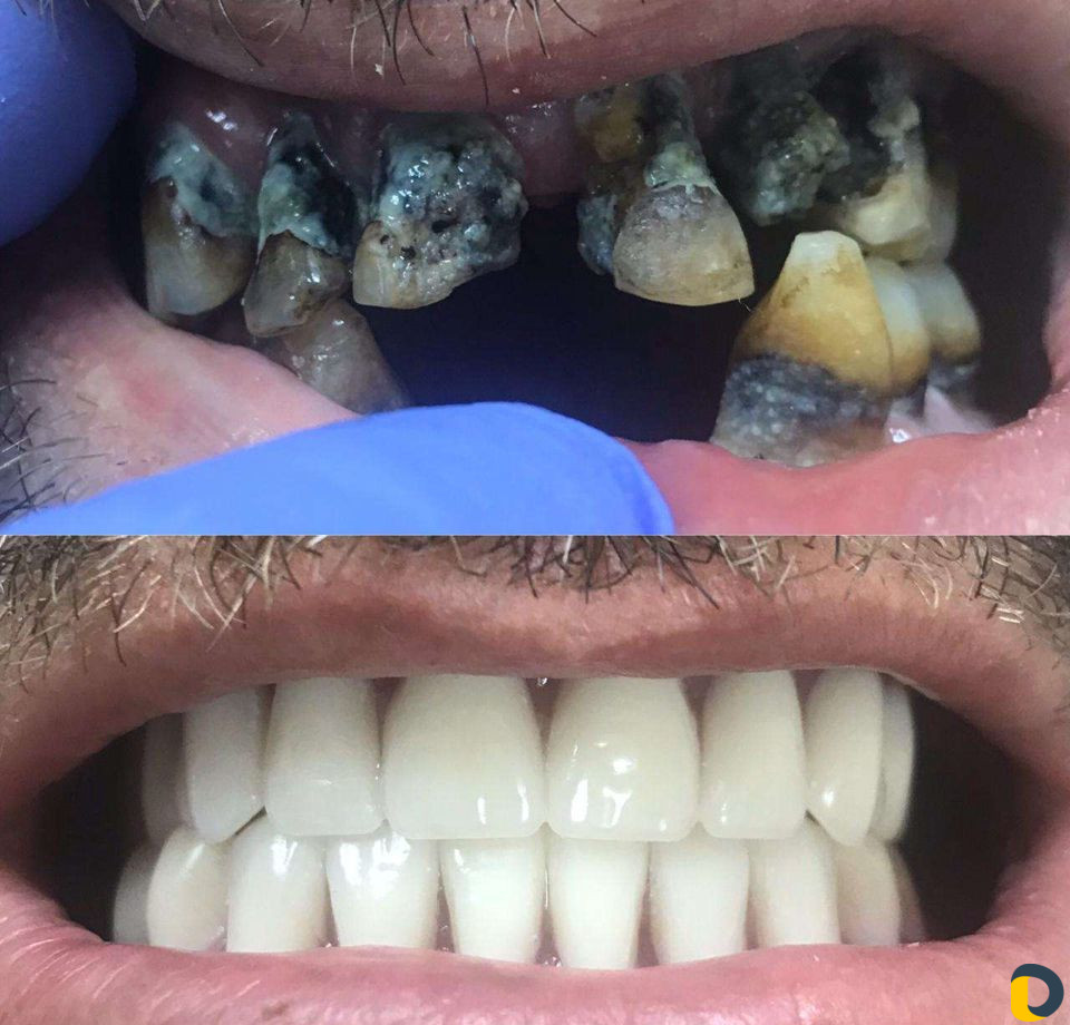 Зубной техник -литейщик