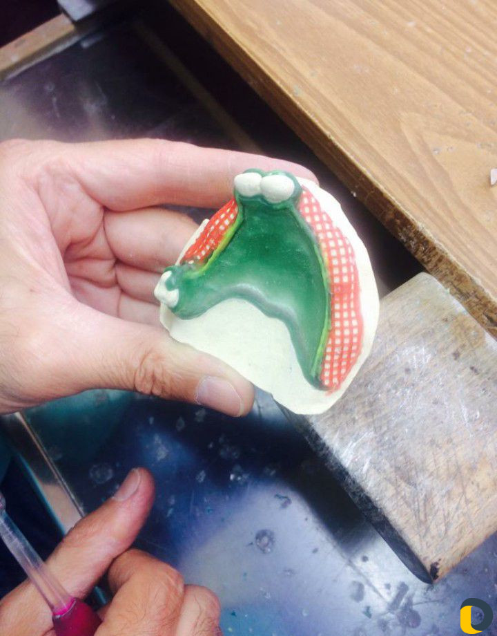 Зубной техник -литейщик