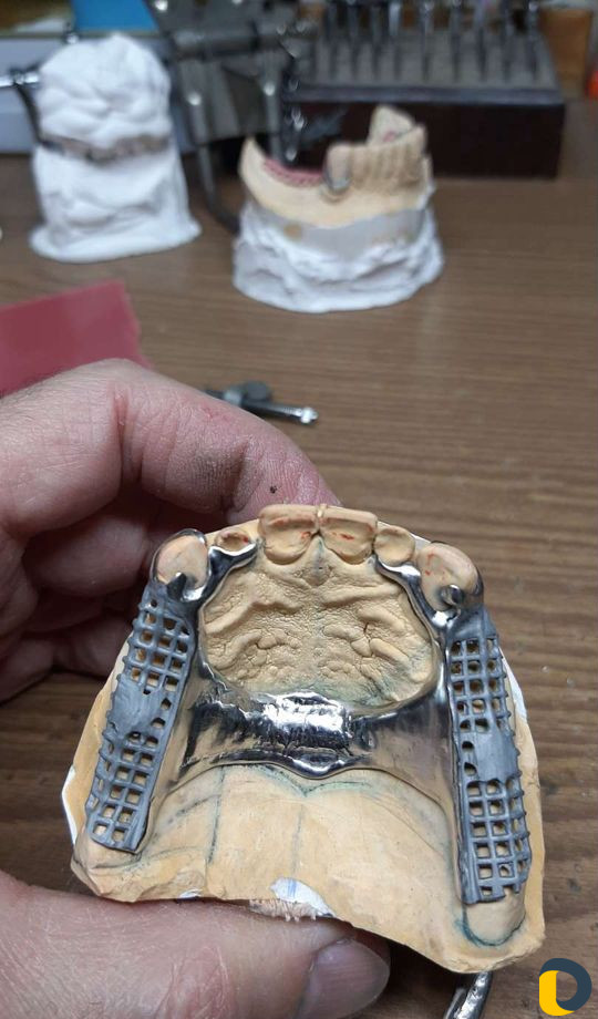 Зубной техник -литейщик