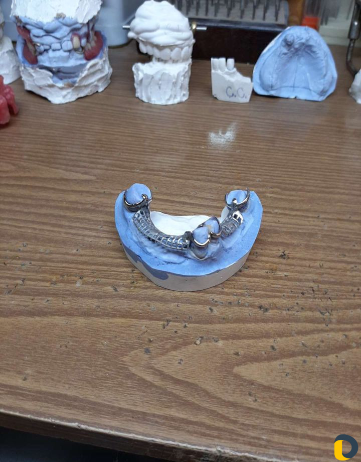 Зубной техник -литейщик