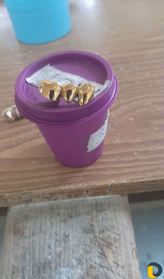 Зубной техник -литейщик