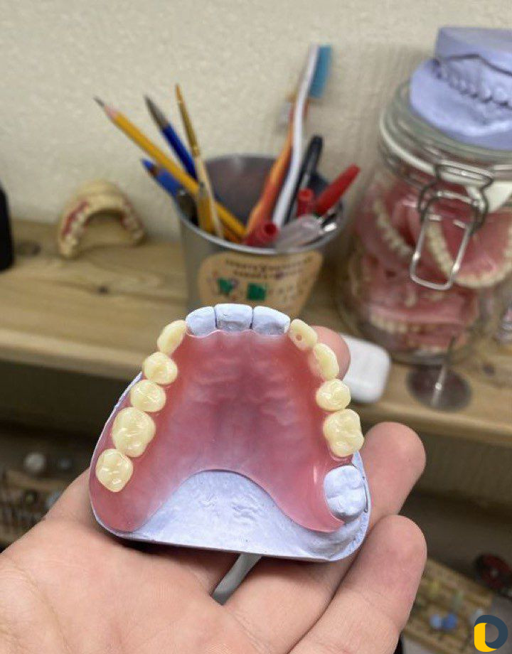 Зубной техник. Съёмное протезирование. Аккуратные